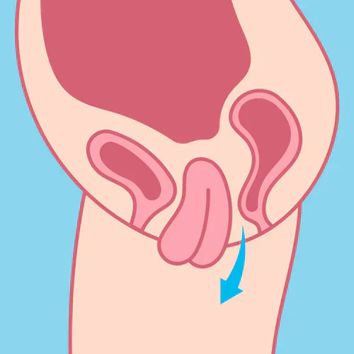 Pelvic Floor Exercises